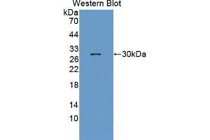 Western blot analysis of the recombinant protein. (NUP62 抗体  (AA 186-432))