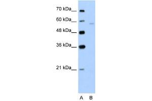 SLC22A7 antibody used at 5 ug/ml to detect target protein. (SLC22A7 抗体)