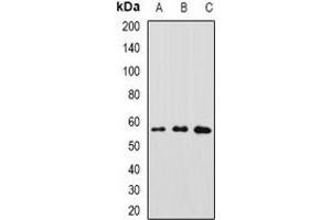 Western blot analysis of GFRA1 expression in MCF7 (A), A549 (B), SW480 (C) whole cell lysates. (GFRA1 抗体)