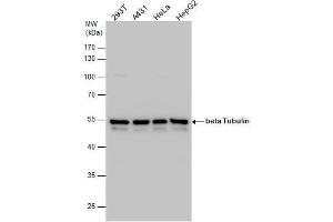 Western Blotting (WB) image for anti-Tubulin, beta (TUBB) antibody (ABIN2854998)
