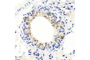 Immunohistochemistry of paraffin-embedded mouse lung using ENDOG antibody at dilution of 1:100 (x40 lens). (Endonuclease G 抗体)