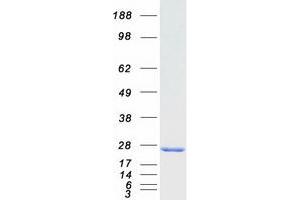 Western Blotting (WB) image for RAB9A, Member RAS Oncogene Family (RAB9A) protein (Myc-DYKDDDDK Tag) (ABIN2730376)