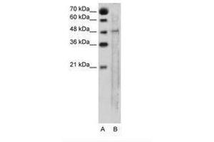 Image no. 1 for anti-Solute Carrier Family 25, Member 46 (SLC25A46) (AA 31-80) antibody (ABIN205025) (SLC25A46 抗体  (AA 31-80))