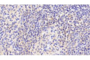 Detection of EFNA3 in Human Spleen Tissue using Polyclonal Antibody to Ephrin A3 (EFNA3) (Ephrin A3 抗体  (AA 30-238))