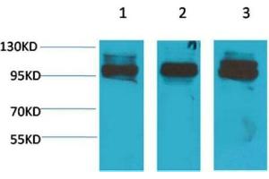 Western Blot (WB) analysis of 1) K562, 2)Mouse Heart Tissue, 3) Rat Heart Tissue with STAT2 Rabbit Polyclonal Antibody diluted at 1:2000. (STAT2 抗体)