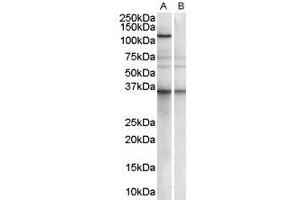 ABIN185369 (1µg/ml) staining of Human Epstein-Barr virus immortilised lymphoblastoid lysate (35µg protein in RIPA buffer) with (B) and without (A) blocking with the immunizing peptide. (PUM2 抗体  (Internal Region))