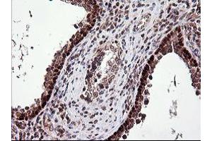 Image no. 1 for anti-Tumor Protein P73 (TP73) (AA 167-409) antibody (ABIN1491006) (Tumor Protein p73 抗体  (AA 167-409))