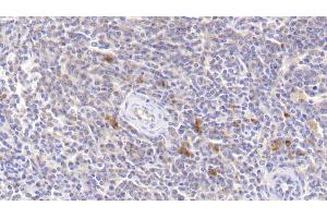 Detection of JAK3 in Human Spleen Tissue using Polyclonal Antibody to Janus Kinase 3 (JAK3) (JAK3 抗体  (AA 716-967))