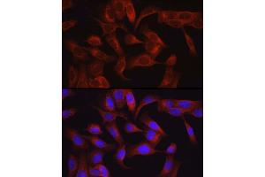 Immunofluorescence (IF) image for anti-Mitogen-Activated Protein Kinase Kinase Kinase 7 (MAP3K7) (AA 300-470) antibody (ABIN6143503)