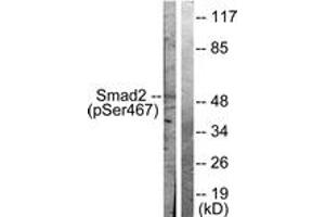Western blot analysis of extracts from HepG2 cells treated with PMA 125ng/ml 15', using Smad2 (Phospho-Ser467) Antibody. (SMAD2 抗体  (pSer467))