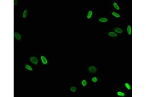 Immunofluorescence staining of Hela cells with ABIN7139197 at 1:7. (HIST1H3A 抗体  (acLys79))