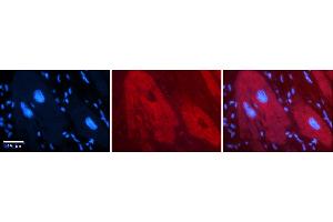 Rabbit Anti-DHX30 Antibody    Formalin Fixed Paraffin Embedded Tissue: Human Adult heart  Observed Staining: Cytoplasmic Primary Antibody Concentration: 1:100 Secondary Antibody: Donkey anti-Rabbit-Cy2/3 Secondary Antibody Concentration: 1:200 Magnification: 20X Exposure Time: 0. (DHX30 抗体  (N-Term))