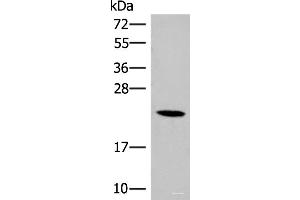 Western blot analysis of 293T cell lysate using DHFR Polyclonal Antibody at dilution of 1:400 (Dihydrofolate Reductase 抗体)