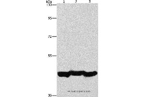 Western blot analysis of A549 cell and mouse liver tissue, hepG2 cell, using PGK1 Polyclonal Antibody at dilution of 1:1000 (PGK1 抗体)