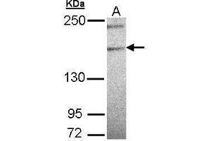 WB Image Sample (30 ug of whole cell lysate) A: 293T 5% SDS PAGE antibody diluted at 1:500 (PLCH1 抗体  (N-Term))