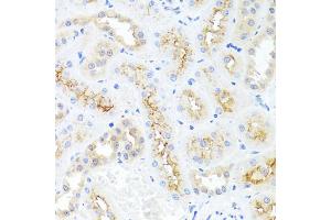 Immunohistochemistry of paraffin-embedded rat kidney using CXCL8 antibody (ABIN6290535) at dilution of 1:100 (40x lens). (IL-8 抗体)