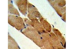 Immunohistochemistry (IHC) image for anti-Tumor Necrosis Factor (Ligand) Superfamily, Member 11 (TNFSF11) (AA 1-30) antibody (ABIN3029354)
