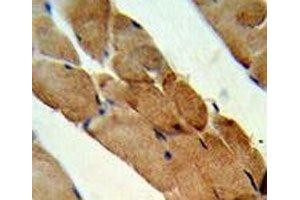 IHC analysis of FFPE human skeletal muscle stained with RANKL antibody (RANKL 抗体  (AA 1-30))