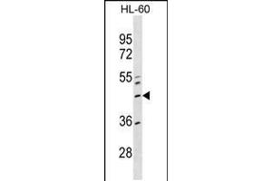 Western blot analysis in HL-60 cell line lysates (35ug/lane). (ZNF589 抗体  (AA 184-210))