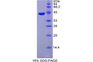 SDS-PAGE analysis of Mouse Parathyroid Hormone Protein. (PTH 蛋白)