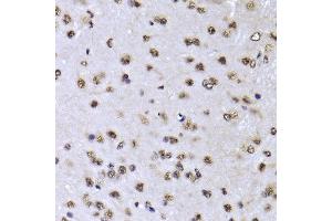 Immunohistochemistry of paraffin-embedded Mouse brain using EFTUD2 antibody at dilution of 1:100 (x400 lens).