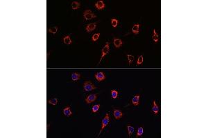 Immunofluorescence analysis of L929 cells using Presenilin 1 Rabbit pAb (ABIN3023159, ABIN3023160, ABIN3023161 and ABIN6219418) at dilution of 1:100 (40x lens).