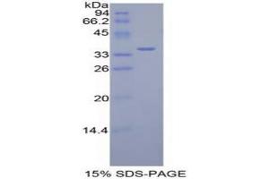SDS-PAGE analysis of Mouse Dispatched Homolog 1 Protein. (DISP1 蛋白)