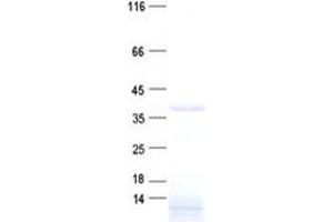 Western Blotting (WB) image for Chromosome 3 Open Reading Frame 38 (C3orf38) protein (His tag) (ABIN2715512)