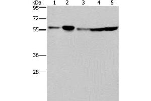 Western Blot analysis of Hela, 293T, A549, HT-29 and K562 cell using NUP50 Polyclonal Antibody at dilution of 1:200 (NUP50 抗体)