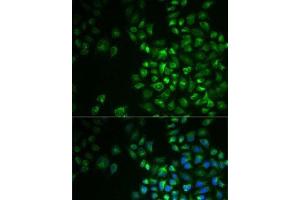 Immunofluorescence analysis of MCF7 cells using POLG2 Polyclonal Antibody (POLG2 抗体)