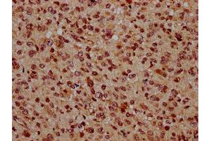 IHC image of ABIN7145737 diluted at 1:500 and staining in paraffin-embedded human glioma performed on a Leica BondTM system. (BSX 抗体  (AA 1-233))