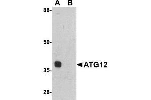 Western blot. (ATG12 抗体  (Middle Region))