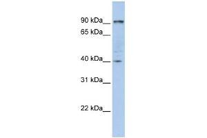 WB Suggested Anti-PYGB Antibody Titration:  0. (PYGB 抗体  (N-Term))