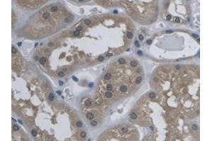 DAB staining on IHC-P; Samples: Human Kidney Tissue (Kallikrein 9 抗体  (AA 1-250))