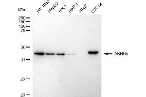 Western blotting analysis using ABHD5 antibody (ABIN7797436). (Recombinant ABHD5 抗体)