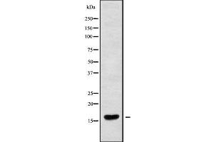 Western blot analysis of RPC9 using HuvEc whole cell lysates (CRCP 抗体  (N-Term))