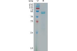 SDS-PAGE (SDS) image for Platelet Derived Growth Factor D (PDGFD) (AA 19-370) protein (His tag) (ABIN7491265)