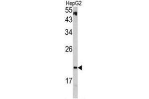 Western blot analysis of VHL antibody (C-term) in HepG2 cell line lysates (35ug/lane). (VHL 抗体  (C-Term))