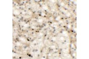 Immunohistochemistry of NKX2-6 in human spleen tissue with NKX2-6 antibody at 5 ug/mL. (NKX2-6 抗体  (Middle Region))