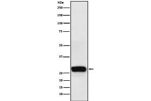 Western blot analysis of beta Casein expression in Human milk lysate.