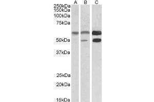Western Blotting (WB) image for anti-Calcium/calmodulin-Dependent Protein Kinase II alpha (CAMK2A) antibody (ABIN5895999) (CAMK2A 抗体)