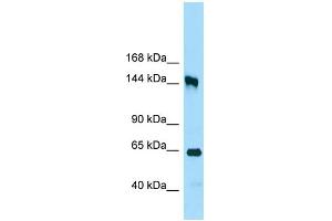WB Suggested Anti-RRP12 Antibody Titration: 1. (RRP12 抗体  (C-Term))