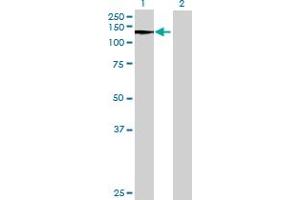Western Blot analysis of DNMT3A expression in transfected 293T cell line by DNMT3A MaxPab polyclonal antibody. (DNMT3A 抗体  (AA 1-912))