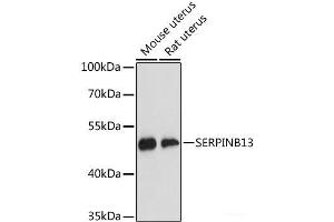 Western blot analysis of extracts of various cell lines using SERPINB13 Polyclonal Antibody at dilution of 1:3000. (SERPINB13 抗体)