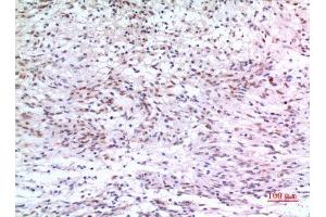 Immunohistochemistry (IHC) analysis of paraffin-embedded Human Brain, antibody was diluted at 1:100. (ZKSCAN4 抗体  (Internal Region))