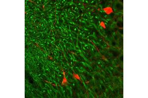 Indirect immunohystochemistry of a rat hippocampus section with anti-MAP 2 (dilution 1 : 500; green) and parvalbumin guinea pig antiserum (cat. (MAP2 抗体  (AA 2-309))