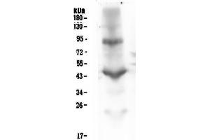 Western blot analysis of CD18 using anti-CD18 antibody (ABIN5692988).