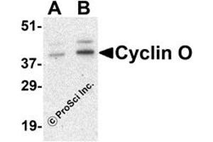 Western Blotting (WB) image for anti-Cyclin O (CCNO) (Middle Region) antibody (ABIN1031155) (Cyclin O 抗体  (Middle Region))
