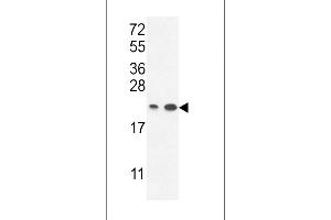 ABHEB Antibody (C-term) (ABIN653654 and ABIN2842995) western blot analysis in ,T47D cell line lysates (35 μg/lane). (ABHD14B 抗体  (C-Term))