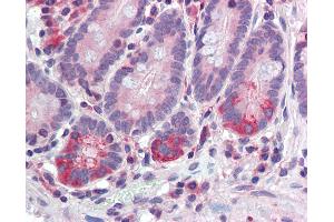 Anti-TDP1 antibody IHC of human small intestine.